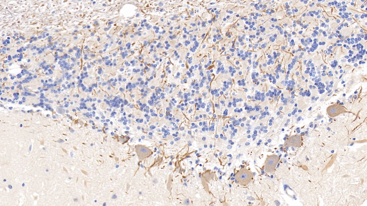 Polyclonal Antibody to Neurofilament, Light Polypeptide (NEFL)