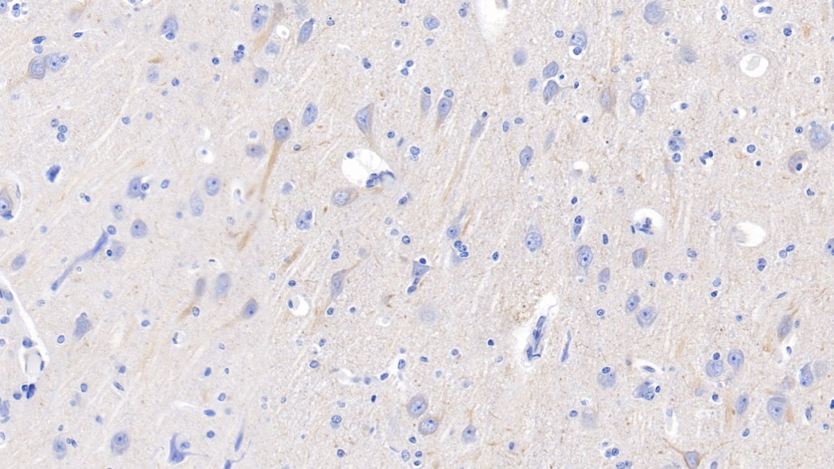 Polyclonal Antibody to Neurofilament, Light Polypeptide (NEFL)