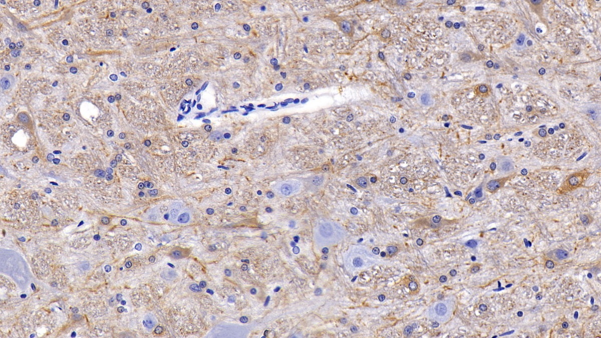 Polyclonal Antibody to Neurofilament, Light Polypeptide (NEFL)