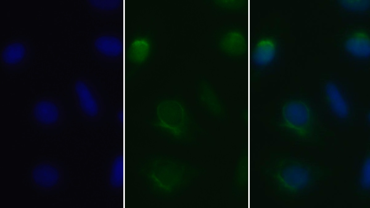 Polyclonal Antibody to Neurofilament, Light Polypeptide (NEFL)