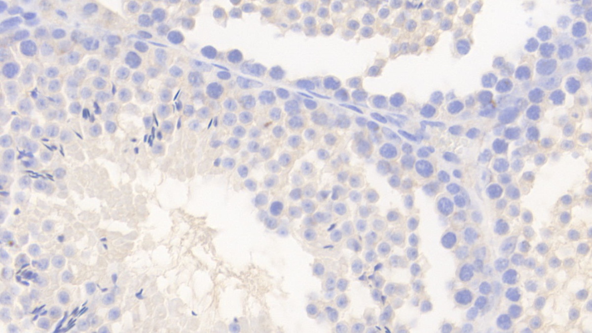 Polyclonal Antibody to Protocadherin 18 (PCDH18)