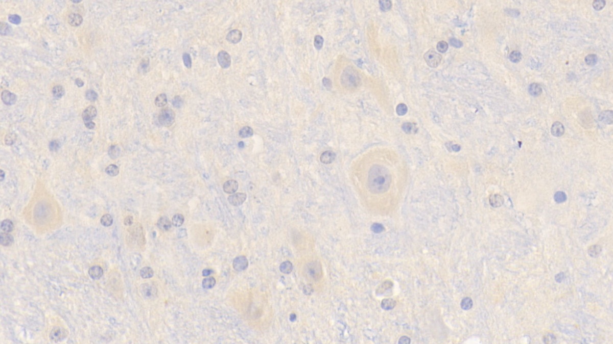 Polyclonal Antibody to Protocadherin 18 (PCDH18)