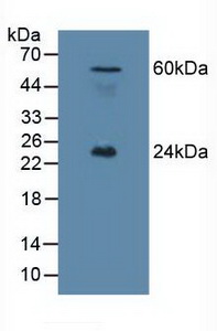 Polyclonal Antibody to Ephrin A1 (EFNA1)