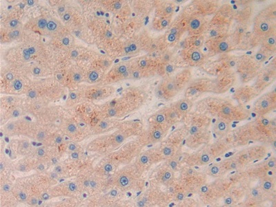 Polyclonal Antibody to Ephrin A5 (EFNA5)