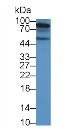 Polyclonal Antibody to Ephrin Type A Receptor 10 (EPHA10)