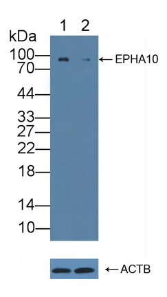 Polyclonal Antibody to Ephrin Type A Receptor 10 (EPHA10)