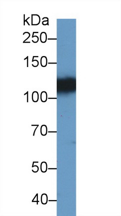 Polyclonal Antibody to Ephrin Type A Receptor 4 (EPHA4)