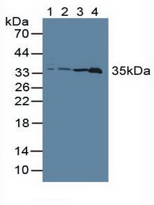 Polyclonal Antibody to Lactate Dehydrogenase C (LDHC)