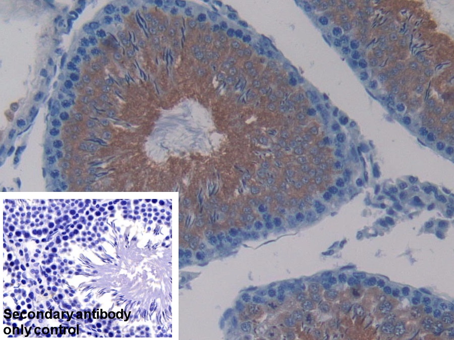 Polyclonal Antibody to Lactate Dehydrogenase C (LDHC)