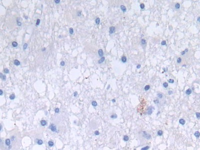 Polyclonal Antibody to Defensin Alpha 3, Neutrophil Specific (DEFa3)