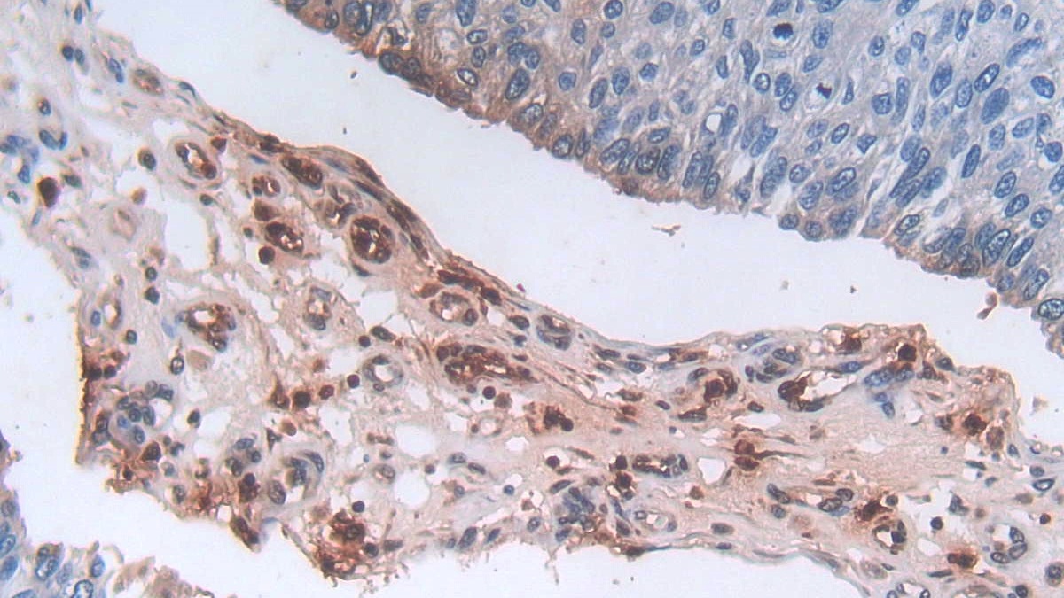 Polyclonal Antibody to Defensin Alpha 3, Neutrophil Specific (DEFa3)