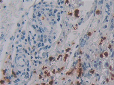 Polyclonal Antibody to Defensin Alpha 4, Corticostatin (DEFa4)