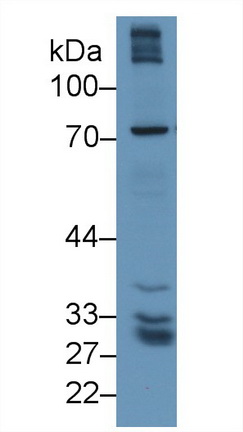 Polyclonal Antibody to Gamma-Glutamyltransferase 5 (gGT5)