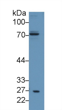 Polyclonal Antibody to Gamma-Glutamyltransferase 5 (gGT5)