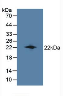 Polyclonal Antibody to Lipocalin 8 (LCN8)