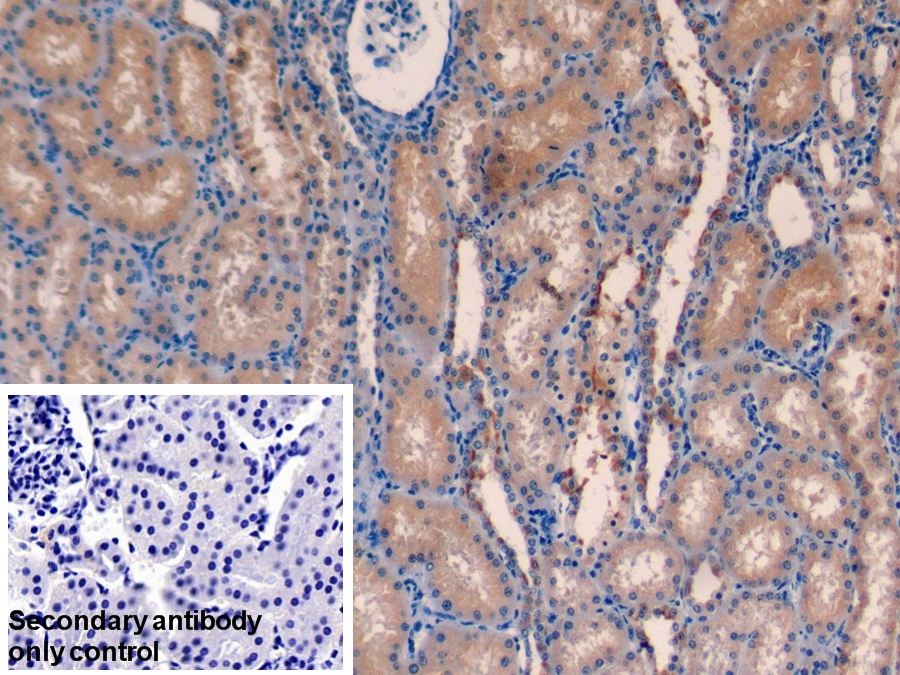 Polyclonal Antibody to Farnesyl Diphosphate Synthase (FDPS)