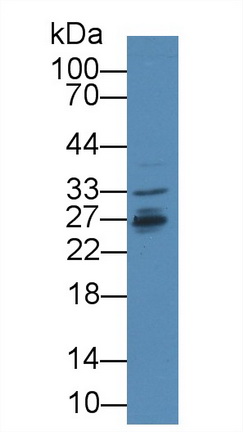 Polyclonal Antibody to Interferon Alpha/Beta Receptor 2 (IFNa/bR2)