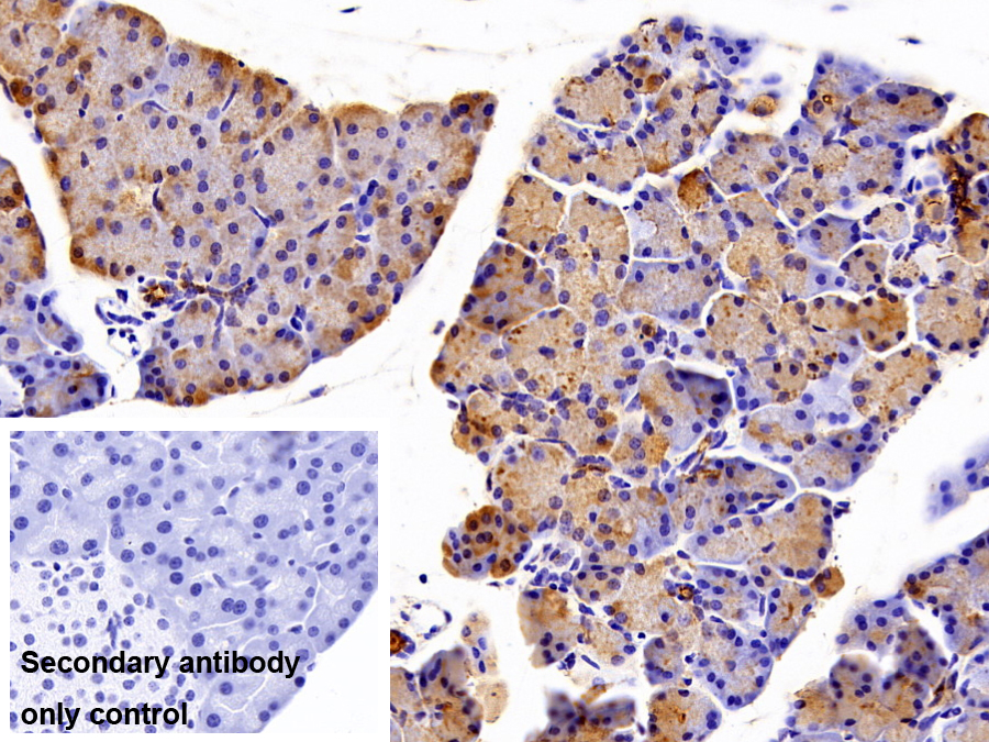 Polyclonal Antibody to Colipase, Pancreatic (CLPS)