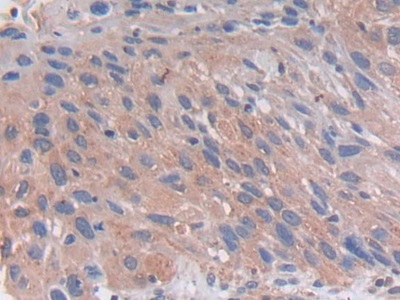 Polyclonal Antibody to Proprotein Convertase Subtilisin/Kexin Type 5 (PCSK5)