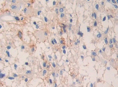 Polyclonal Antibody to Proprotein Convertase Subtilisin/Kexin Type 9 (PCSK9)