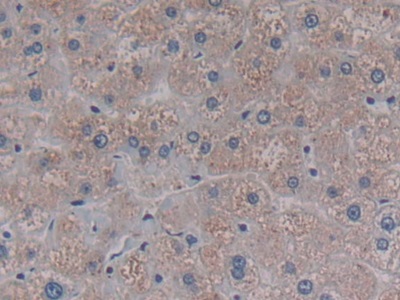 Polyclonal Antibody to Proprotein Convertase Subtilisin/Kexin Type 9 (PCSK9)