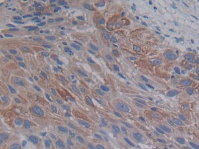 Polyclonal Antibody to Proprotein Convertase Subtilisin/Kexin Type 9 (PCSK9)