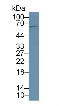 Polyclonal Antibody to Proprotein Convertase Subtilisin/Kexin Type 9 (PCSK9)