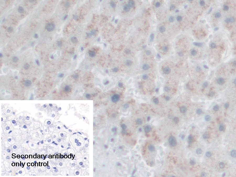 Polyclonal Antibody to Proprotein Convertase Subtilisin/Kexin Type 1 (PCSK1)