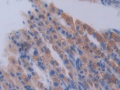 Polyclonal Antibody to Proprotein Convertase Subtilisin/Kexin Type 1 (PCSK1)