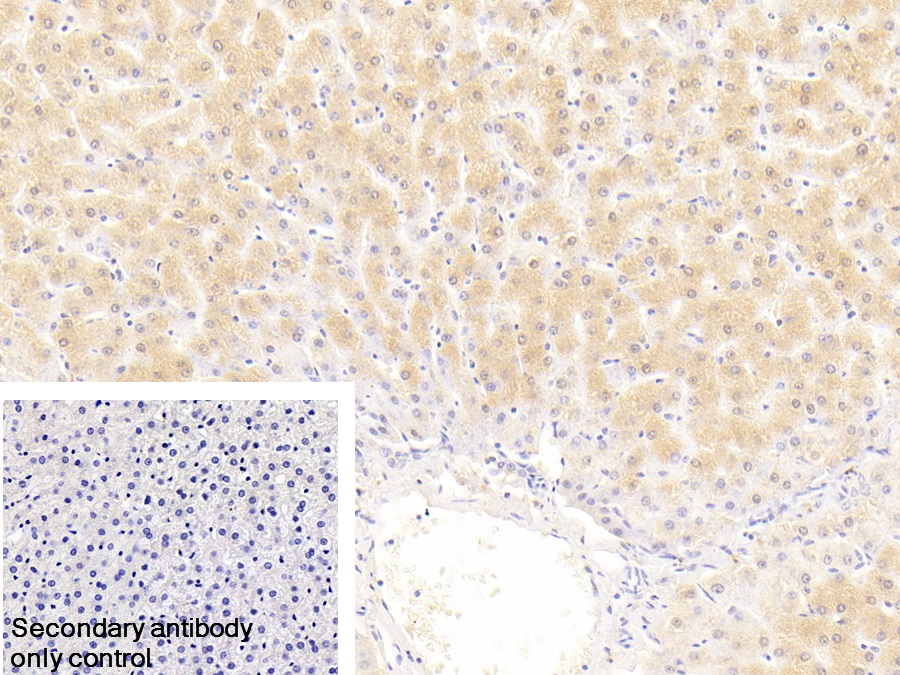 Polyclonal Antibody to Puromycin Sensitive Aminopeptidase (PSA)