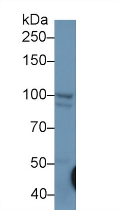 Polyclonal Antibody to Puromycin Sensitive Aminopeptidase (PSA)