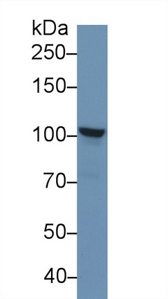 Polyclonal Antibody to Puromycin Sensitive Aminopeptidase (PSA)