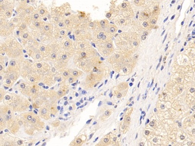 Polyclonal Antibody to Puromycin Sensitive Aminopeptidase (PSA)