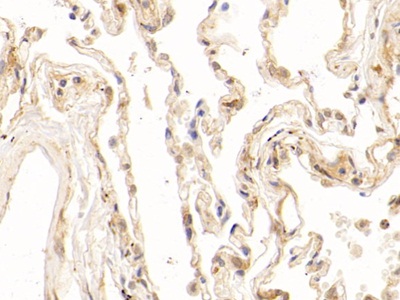 Polyclonal Antibody to Puromycin Sensitive Aminopeptidase (PSA)