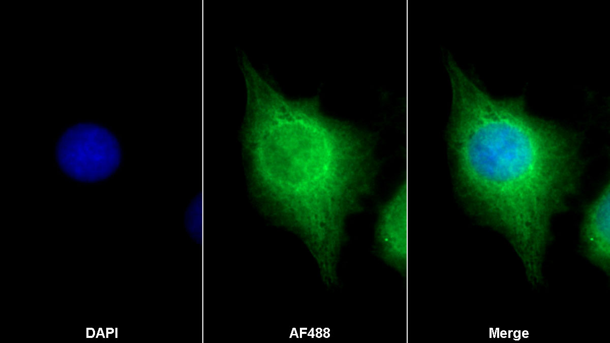 Polyclonal Antibody to Puromycin Sensitive Aminopeptidase (PSA)