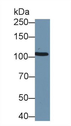 Polyclonal Antibody to Puromycin Sensitive Aminopeptidase (PSA)