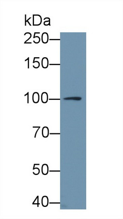 Polyclonal Antibody to Puromycin Sensitive Aminopeptidase (PSA)