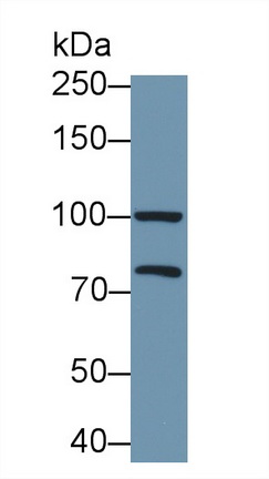 Polyclonal Antibody to Puromycin Sensitive Aminopeptidase (PSA)