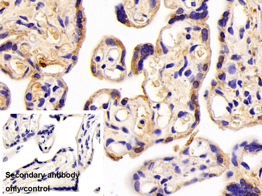 Polyclonal Antibody to Puromycin Sensitive Aminopeptidase (PSA)