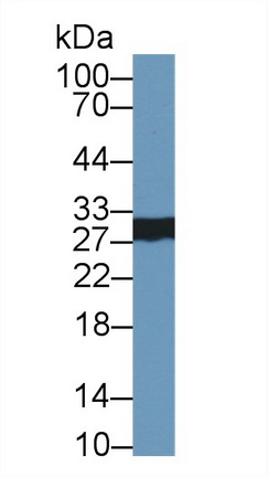 Polyclonal Antibody to Elastase 2A (ELA2A)