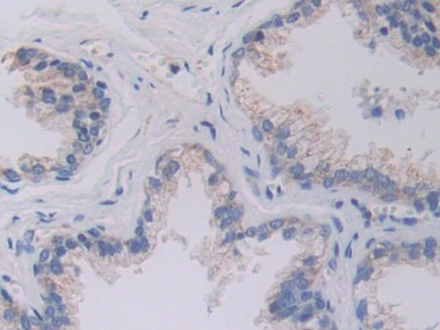 Polyclonal Antibody to Serine Hydroxymethyltransferase 2, Mitochondrial (SHMT2)