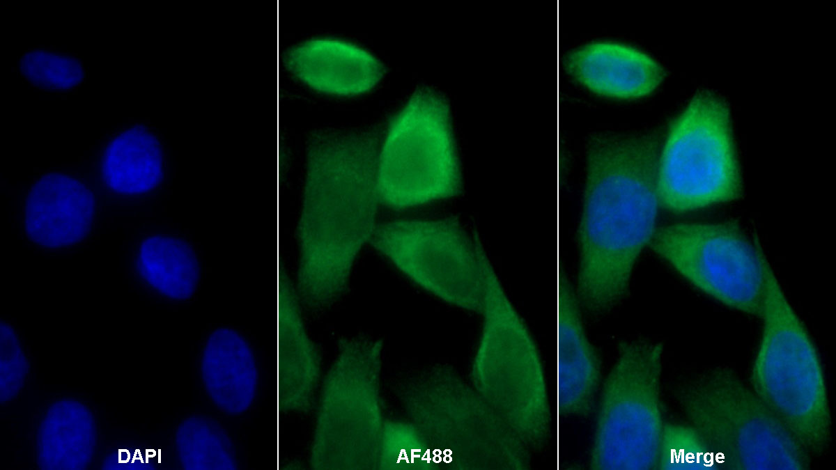 Polyclonal Antibody to Serine Hydroxymethyltransferase 2, Mitochondrial (SHMT2)