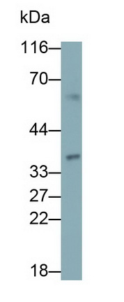 Polyclonal Antibody to Beta-Carotene-15,15'-Monooxygenase 1 (bCMO1)