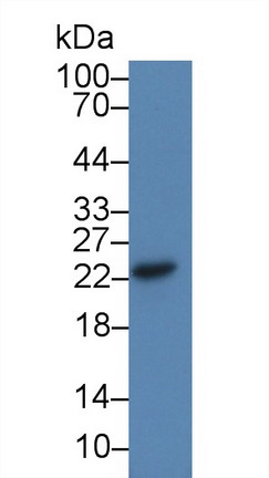 Polyclonal Antibody to Cysteine Dioxygenase I (CDO1)