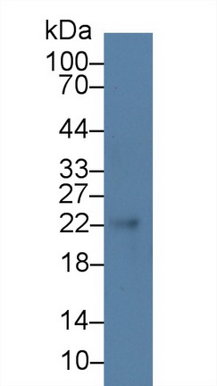 Polyclonal Antibody to Cysteine Dioxygenase I (CDO1)