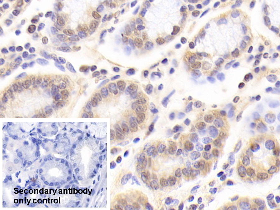 Polyclonal Antibody to Homogentisate-1,2-Dioxygenase (HGD)