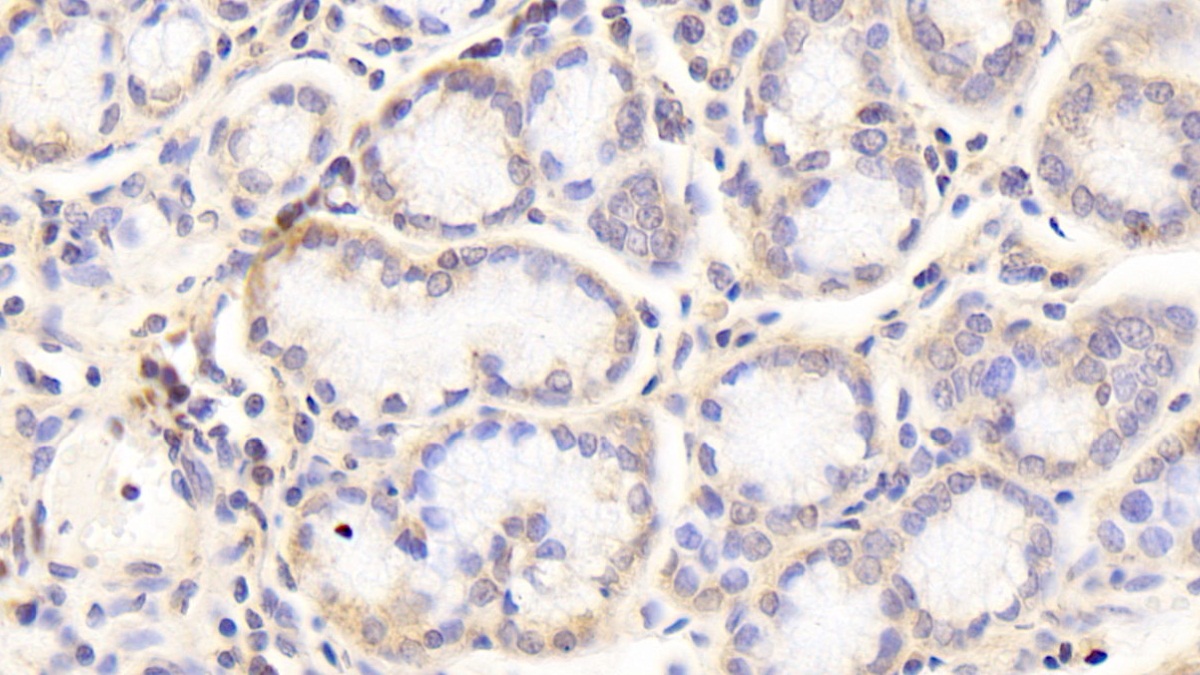 Polyclonal Antibody to Homogentisate-1,2-Dioxygenase (HGD)