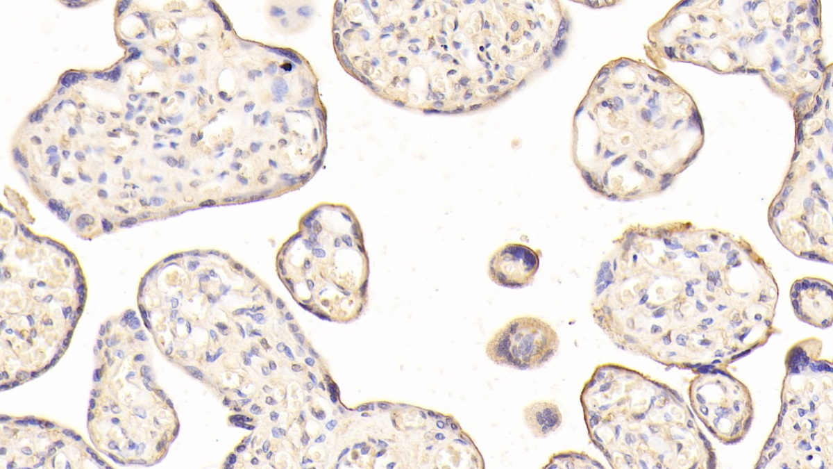 Polyclonal Antibody to Homogentisate-1,2-Dioxygenase (HGD)