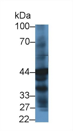 Polyclonal Antibody to 4-Hydroxyphenylpyruvate Dioxygenase (HPD)