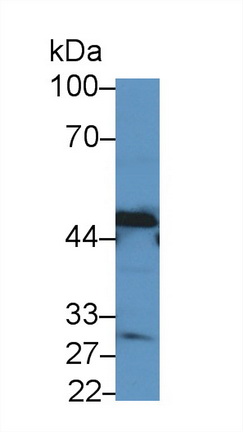 Polyclonal Antibody to 4-Hydroxyphenylpyruvate Dioxygenase (HPD)